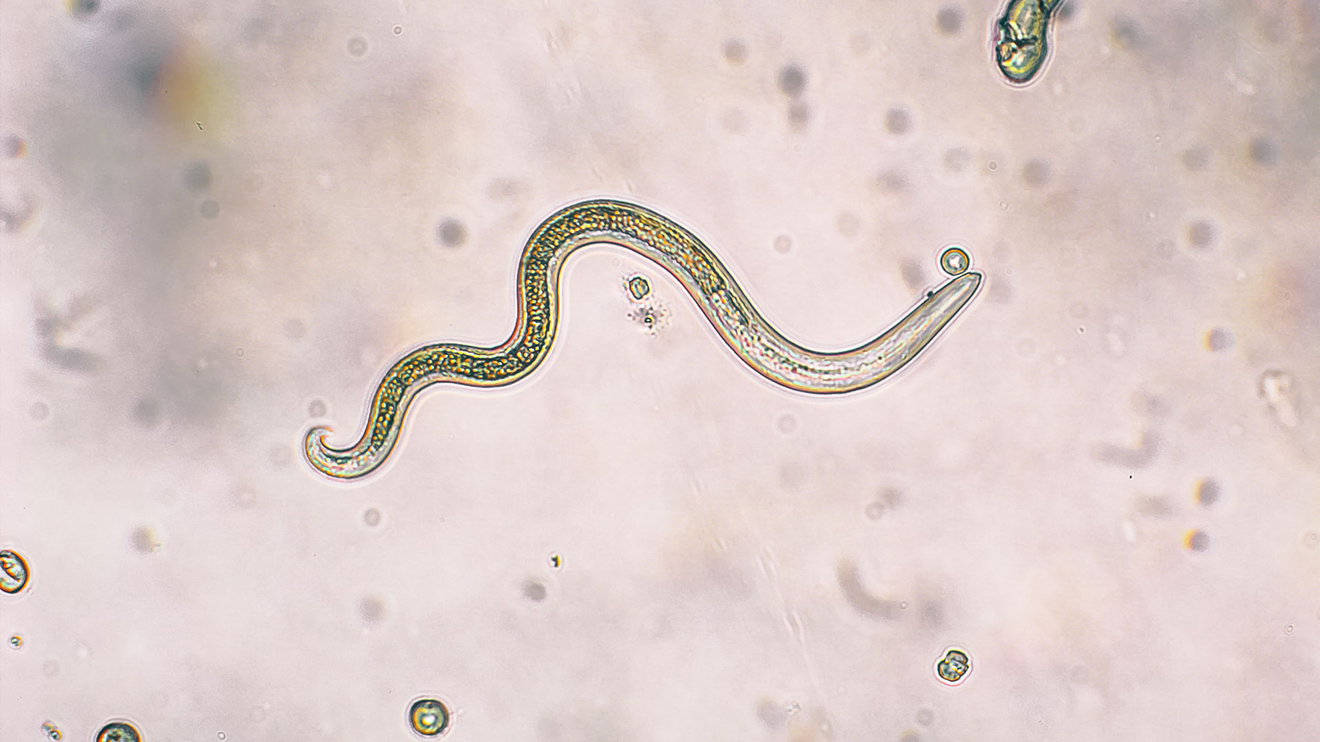 Parasitic worm under microscope